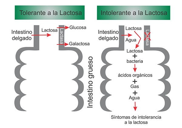 lactosa síntomas